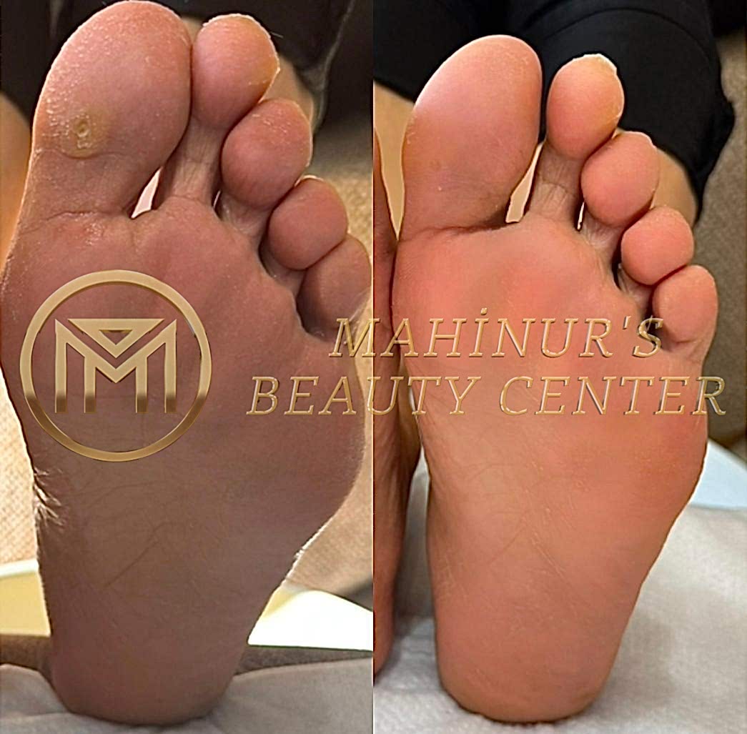 Manikür & Pedikür